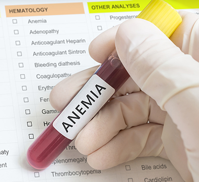 Sickle Cell Anemia - A Pipeline Analysis Report